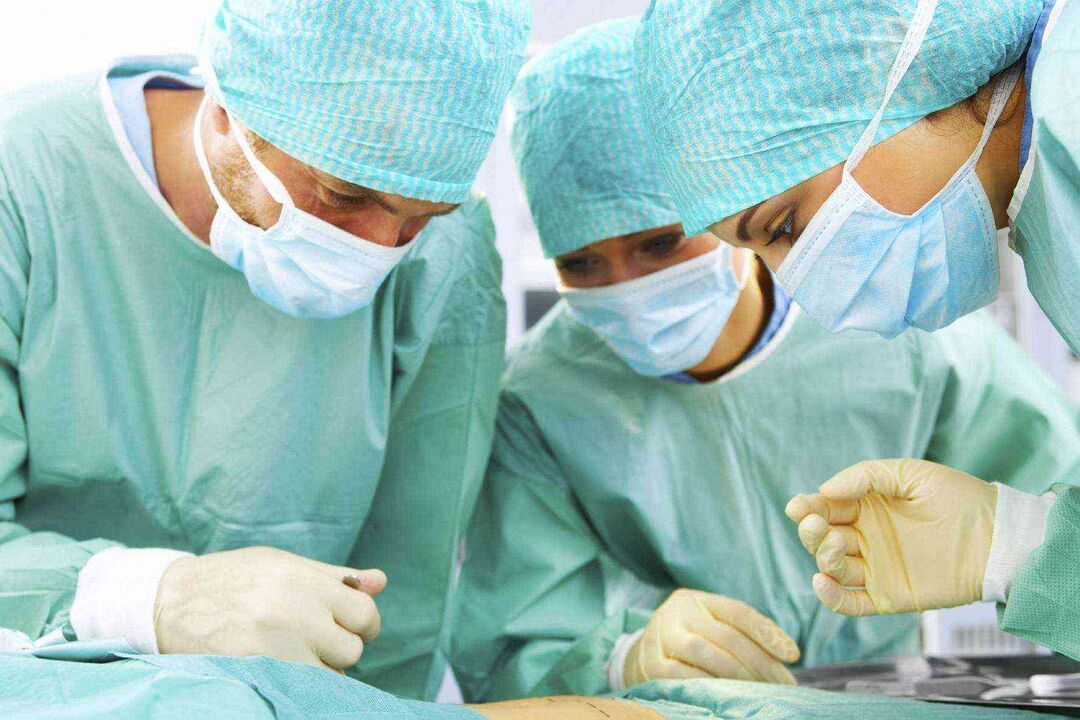 Phẫu thuật tăng kích thước dương vật và giá của nó ảnh 3