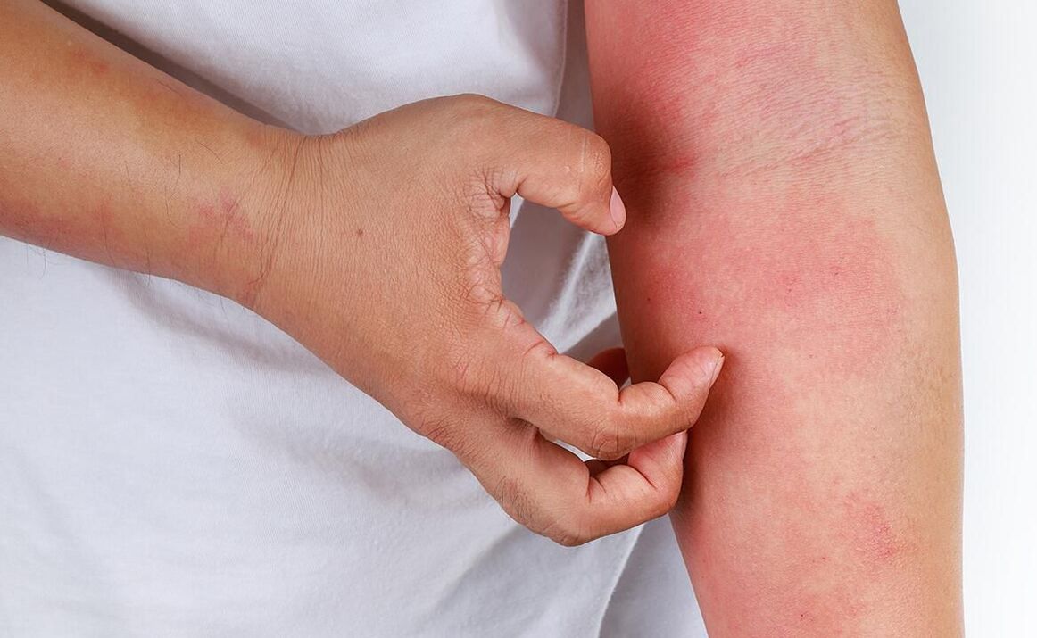 các biến chứng có thể xảy ra khi sử dụng soda