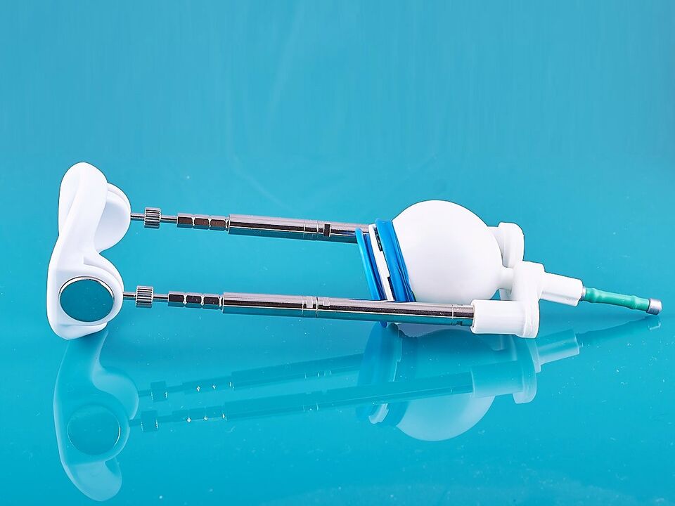 Dụng cụ kéo dài sẽ giúp cải thiện kết quả phẫu thuật cắt dây chằng