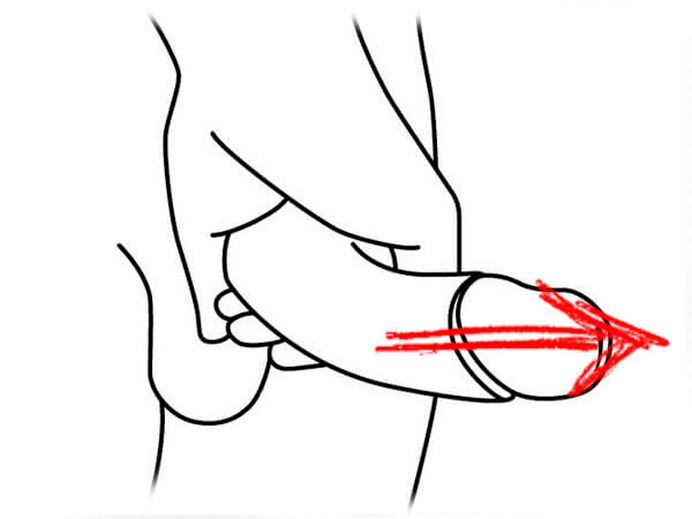 kéo dài dương vật để mở rộng